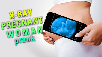 Image 0 for X-Ray Pregnant Woman Pran…