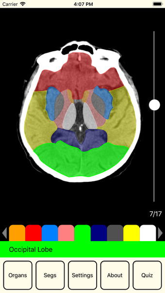 Image 0 for RadAnatomyLite